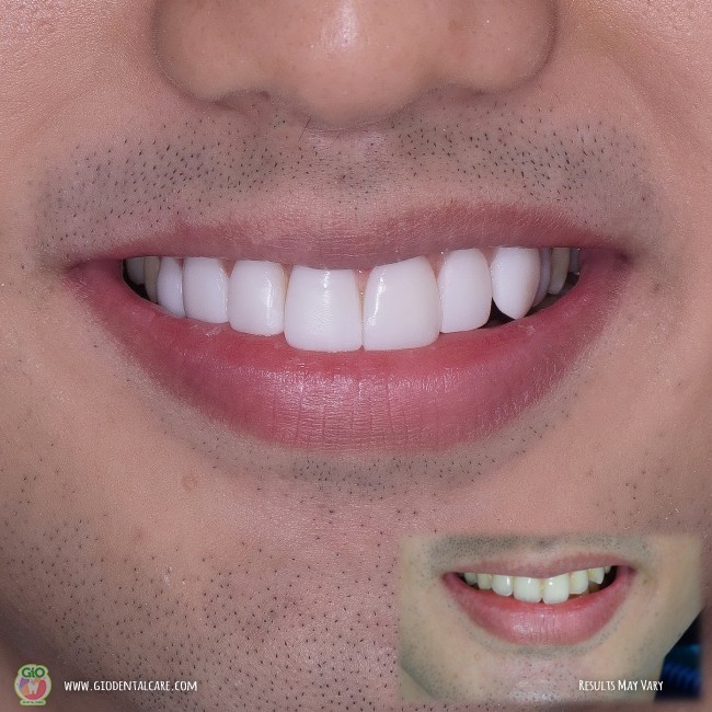 get-your-smile-here-